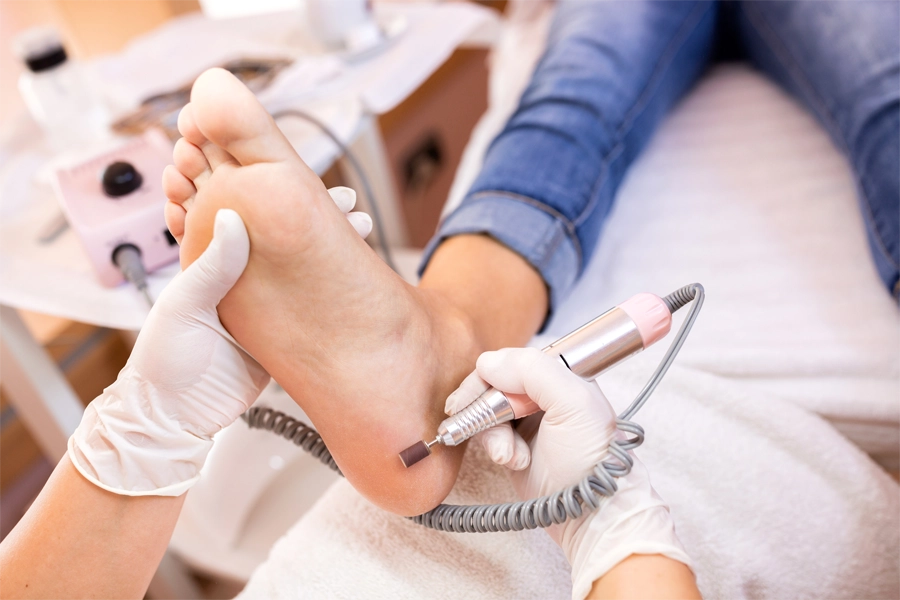 Procedimento de Podologia Preventiva no Centro Podal